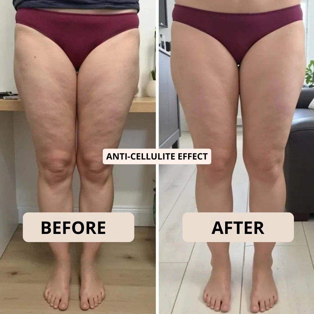 CoolForm™ Menopause Relief Shorts